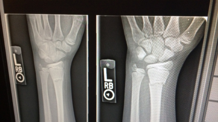 Do You Need an X-Ray? Here’s What You Should Know
